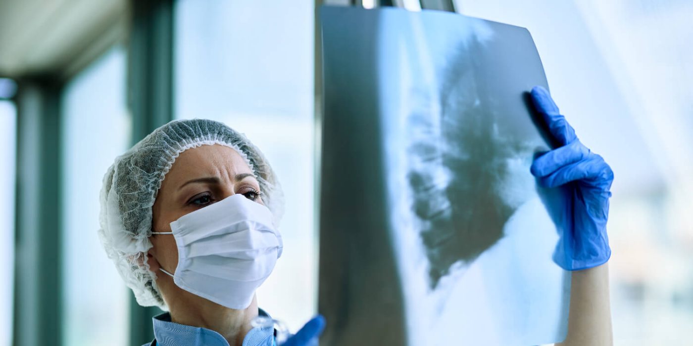 Mesothelioma Prognosis