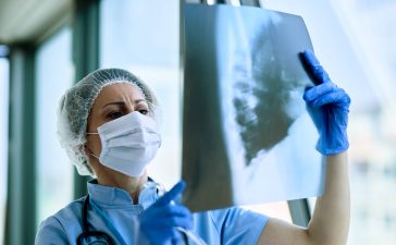Mesothelioma Prognosis